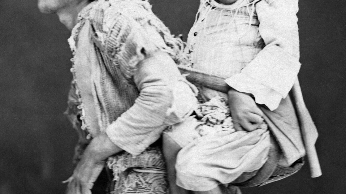 A Blind Man Taught Himself to Echolocate Like a Bat — and Now Rides a Bike at Full Speed