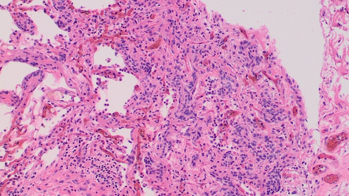 38-Minute Conflict: The Anglo-Zanzibar War of 1896